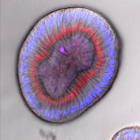 Organoid