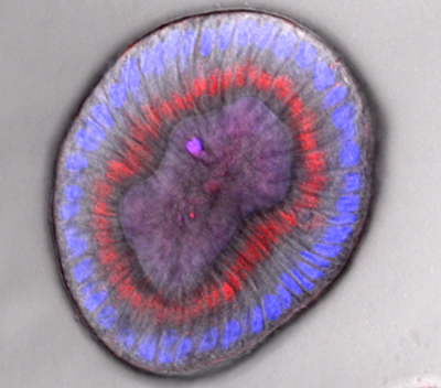 Organoid